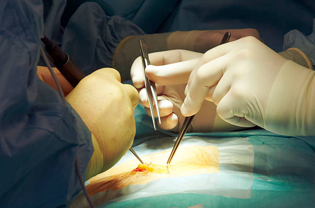 laparoscopic hernia surgeon